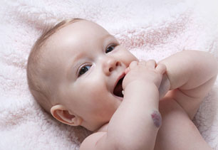 Hémangiomes infantiles