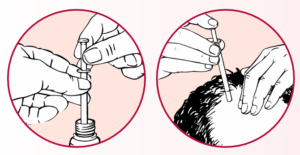 La pipette doseuse facilite le traitement avec le produit pour la croissance des cheveux ALOPEXY®